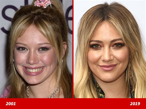 hillary duff plastic surgery|I Didnt Even Recognize Her: Hilary Duffs。